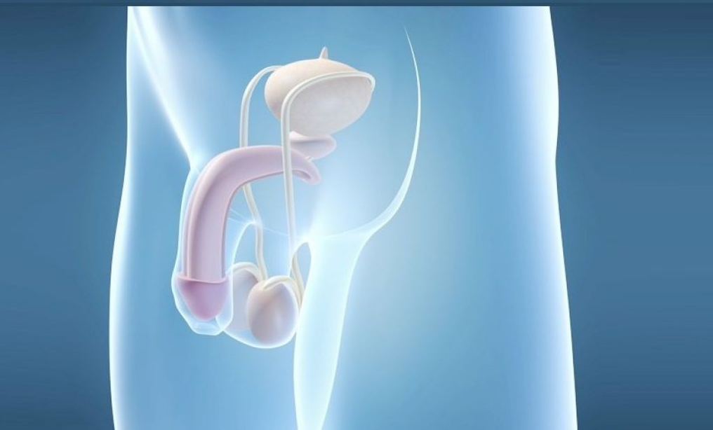 假体植入术是一种增大男性阴茎的手术方法。